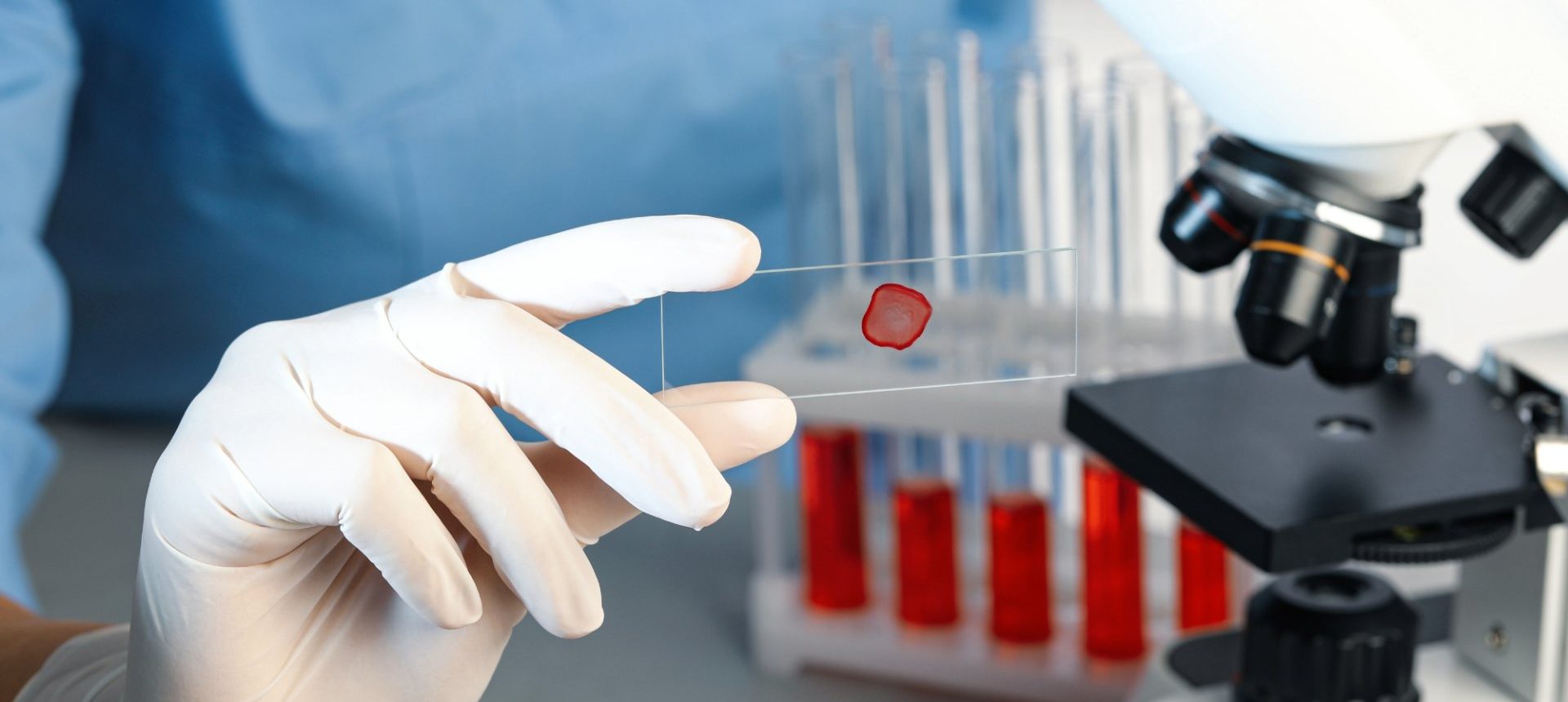 Gloved hand holding a sample slide beside a microscope, the lab side of connected medtech device support